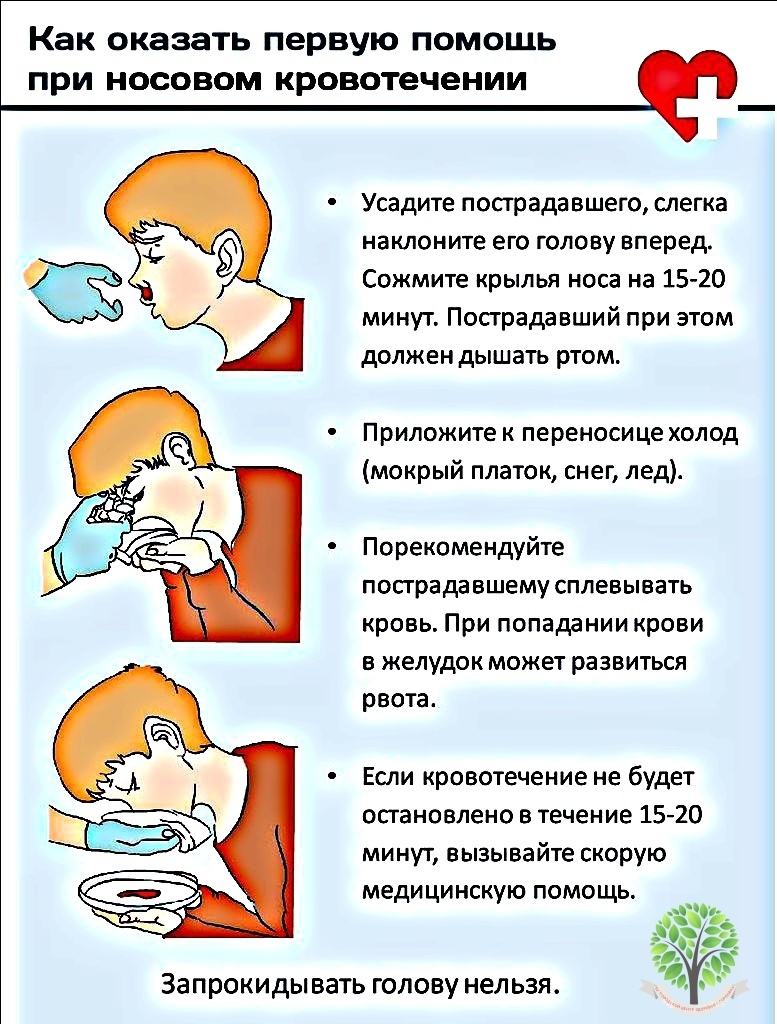 Остановить носовое кровотечение в домашних